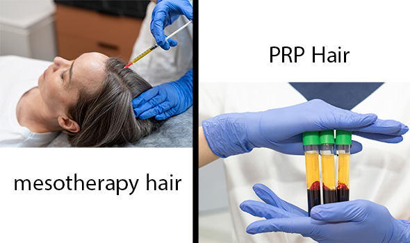مزوتراپی مو بهتر است یا پی آر پی؟