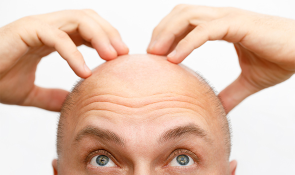 روش های مورد استفاده برای درمان ریزش مو در مردان