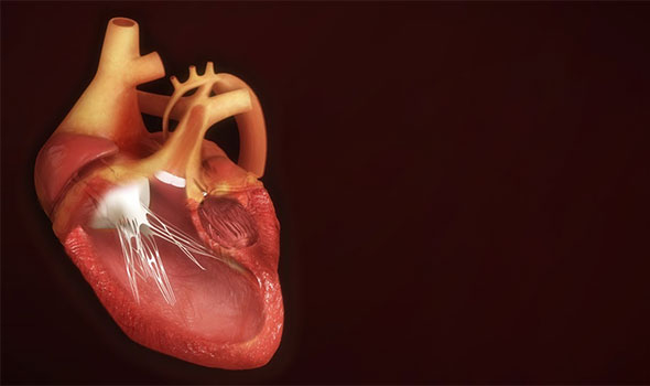 انواع بیماری قلبی در نوزادان
