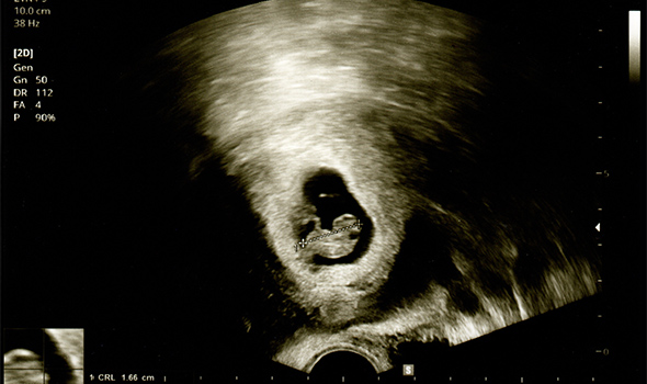 تغییرات ماه دوم بارداری