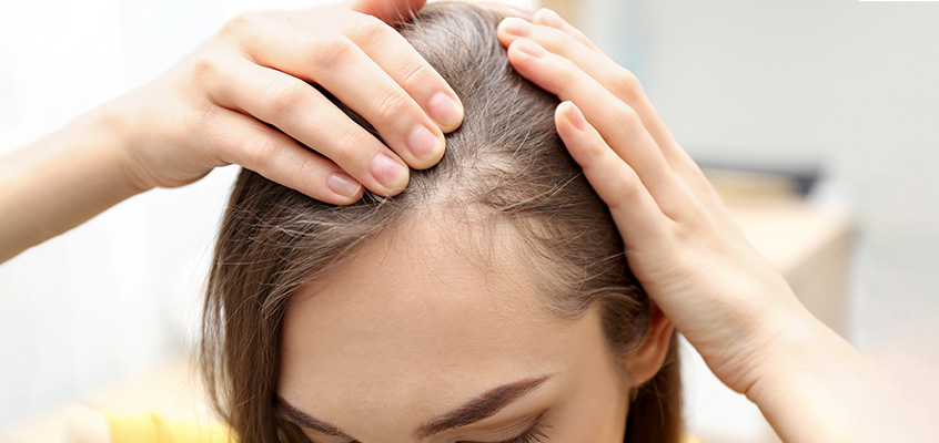 درمان خانگی ریزش مو شدید در زنان