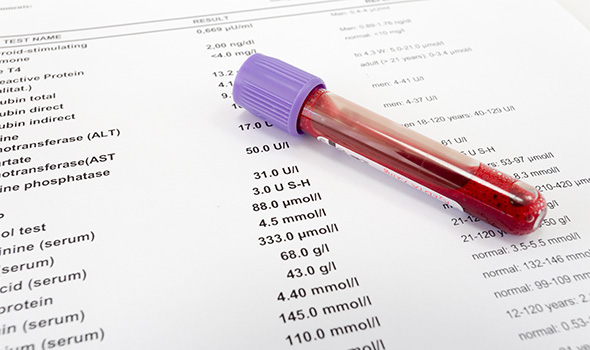 Mchc در آزمایش خون چیست؟
