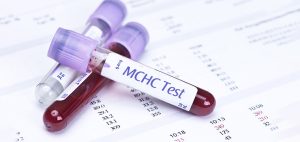 mchc در آزمایش خون