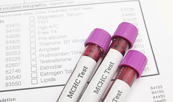 تفسیر نتایج Mchc در آزمایش خون