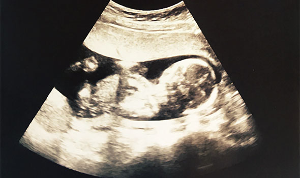 تغییرات جنین در ماه چهارم بارداری