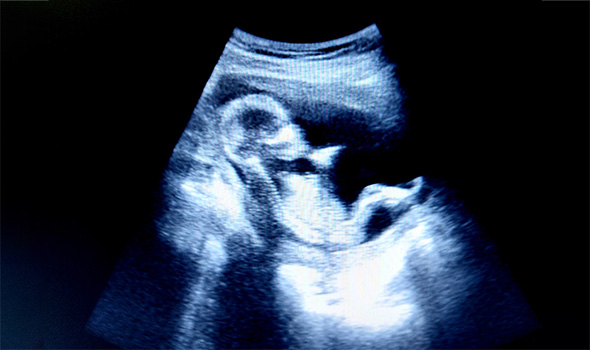 عکس جنین 14 هفته پسر
