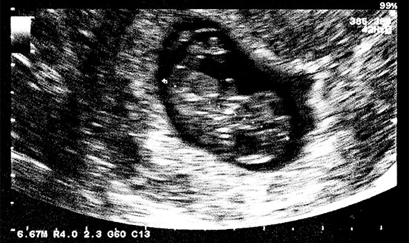 تغییرات جنین در هفته هفتم بارداری